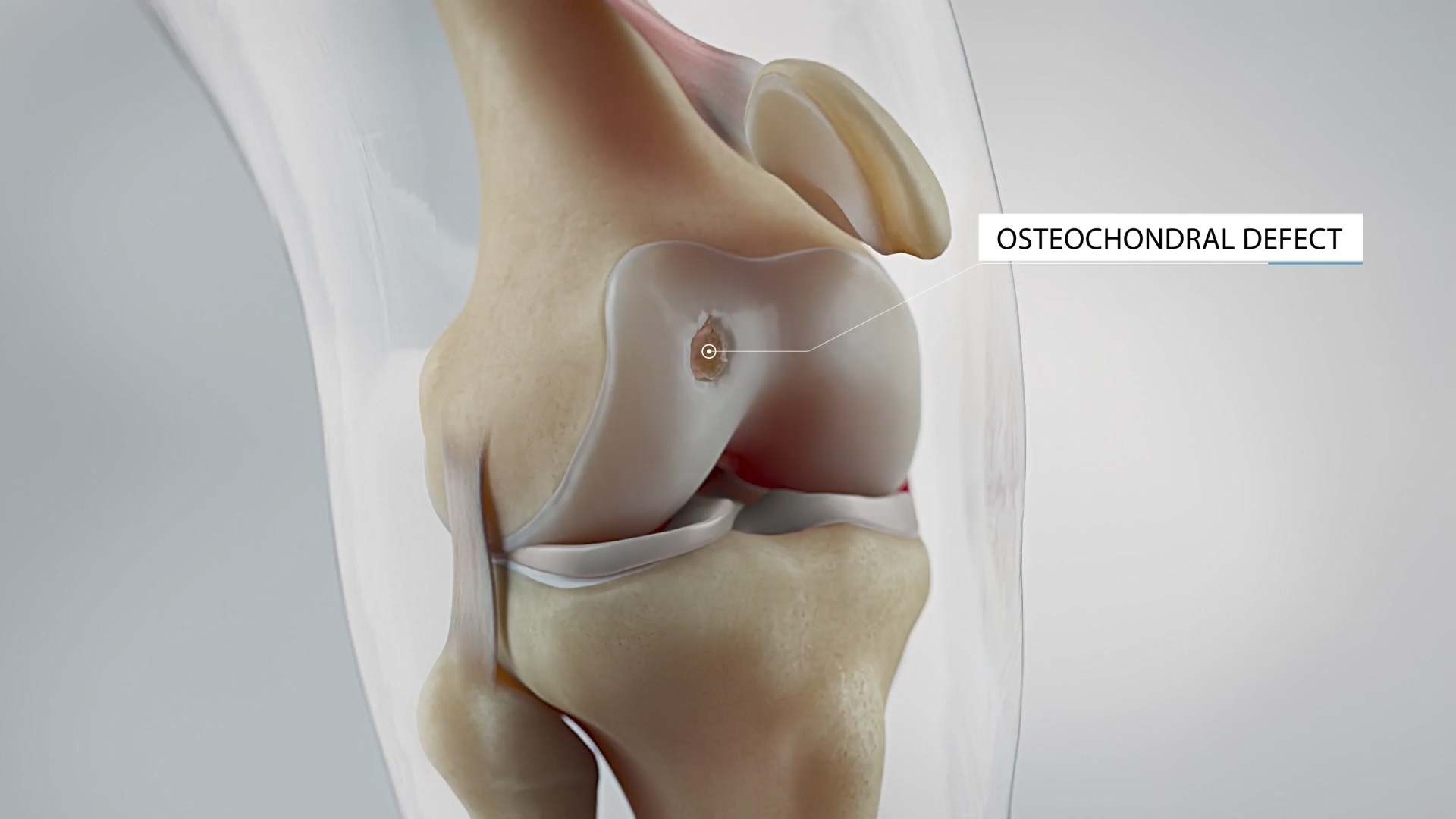 4_leuven_final.mp4_snapshot_00.15.015