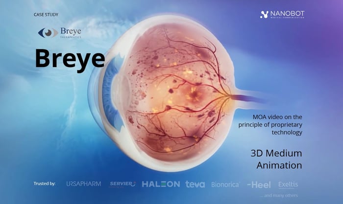 Breye case study - main