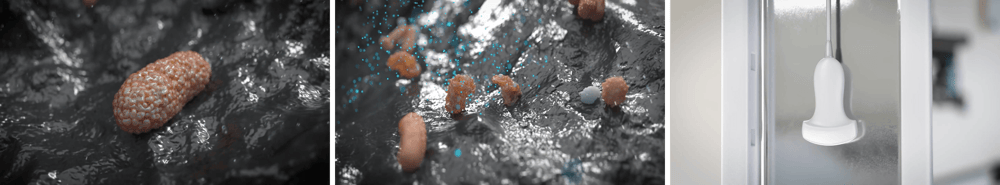 nanosonics_results