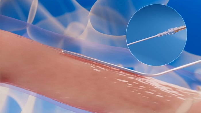 wise-case-study-main